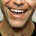 دلیل فاصله بین دندان ها چیست؟